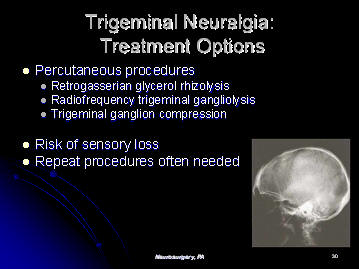 trigeminal neuralgia additional treatment options