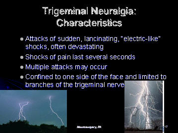 lancinating shock like electric pain of trigeminal neuralgia, houston, tx, texas, usa